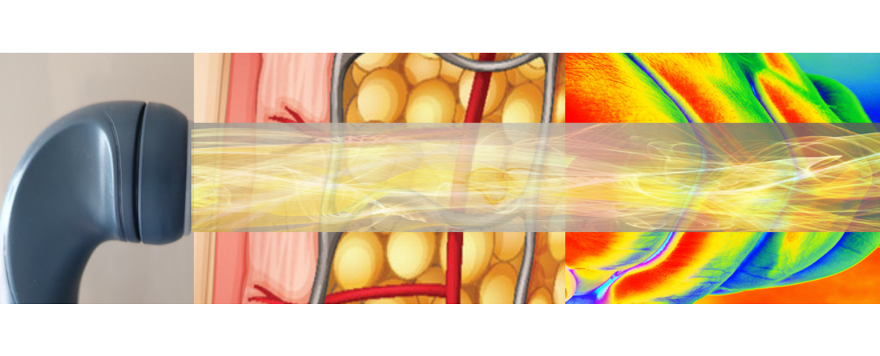 How Does Tecarpuls Work?